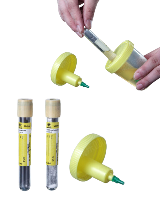 Urine Container Kit with collection tube 10ml